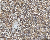 IHC staining of FFPE human testicular germ cell tumor tissue with NPEPPS antibody. HIER: boil tissue sections in pH8 EDTA for 20 min and allow to cool before testing.
