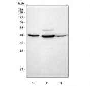 Prostaglandin Reductase 2 Antibody Western Blot. Western blot analysis of human MCF7 (lane 1), RT4 (lane 2), and Caco-2 (lane 3) cell lysates using Prostaglandin Reductase 2 Antibody demonstrates a distinct band at approximately 38-40 kDa, consistent with the predicted molecular weight of PTGR2. Prostaglandin Reductase 2 is an NADPH-dependent oxidoreductase involved in prostaglandin metabolism and the regulation of eicosanoid signaling pathways. Detection of the expected molecular weight band across multiple human cell lines supports expression of PTGR2 and the utility of this antibody for western blot applications.