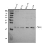 NME6 Antibody Human Cancer Cell WB. Western blot analysis was performed with NME6 Antibody on human LNCaP prostate cancer, U2OS osteosarcoma, Caco-2 colorectal cancer and A431 epidermoid carcinoma cell lysates (lanes 1-4). Samples were separated by 5-20% SDS-PAGE under reducing conditions, and the antibody was used at 0.5 ug/ml overnight at 4oC. A specific band is detected at approximately 21 kDa, consistent with the expected molecular weight of NME6. This NME6 Antibody demonstrates detection of Nucleoside Diphosphate Kinase 6 across multiple human cancer cell lines.