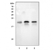 Western blot testing of 1) human SH-SY5Y, 2) rat brain and 3) mouse brain tissue lysate with NEEP21 antibody. Predicted molecular weight ~21 kDa.