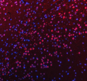 Immunofluorescent staining of FFPE mouse brain tissue with PUS7L antibody (red) and DAPI nuclear stain (blue). HIER: steam section in pH8 EDTA buffer for 20 min.