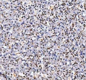 IHC staining of FFPE human spleen tissue with Aryl Hydrocarbon Receptor Repressor antibody. HIER: boil tissue sections in pH8 EDTA for 20 min and allow to cool before testing.
