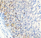 IHC staining of FFPE mouse stomach tissue with LYPLA2 antibody. HIER: boil tissue sections in pH8 EDTA for 20 min and allow to cool before testing.