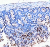J Chain Antibody Rat Colon IHC. Immunohistochemistry of FFPE rat colon tissue using J Chain antibody demonstrates focal HRP-DAB brown cytoplasmic staining in scattered lamina propria immune cells and mucosal-associated plasma cell populations, consistent with JCHAIN / IGJ expression involved in secretory immunoglobulin production and mucosal immune defense. HIER: boil tissue sections in pH8 EDTA for 20 min and allow to cool before testing.