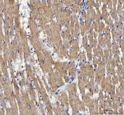 IHC staining of FFPE rat heart tissue with ATP5F1D antibody. HIER: boil tissue sections in pH8 EDTA for 20 min and allow to cool before testing.