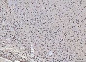 IHC staining of FFPE rat brain tissue with Matrin 3 antibody. HIER: boil tissue sections in pH8 EDTA for 20 min and allow to cool before testing.