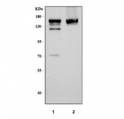 Western blot testing of 1) rat liver and 2) mouse liver tissue lysate with DAPK1 antibody. Predicted molecular weight ~160 kDa with multiple isoforms.