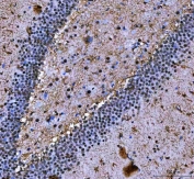 IHC staining of FFPE rat brain tissue with ILF2 antibody. HIER: boil tissue sections in pH8 EDTA for 20 min and allow to cool before testing.