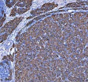 IHC staining of FFPE rat ovary tissue with MELK antibody. HIER: boil tissue sections in pH8 EDTA for 20 min and allow to cool before testing.