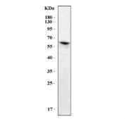Western blot testing of human MCF7 cell lysate with Angulin-2 antibody. Predicted molecular weight ~63 kDa.