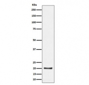 Western blot testing of human HepG2 cell lysate with COPS8 antibody. Predicted molecular weight ~23 kDa and ~18 kDa (two isoforms).