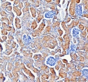 IHC staining of FFPE mouse kidney tissue with IARS2 antibody. HIER: boil tissue sections in pH8 EDTA for 20 min and allow to cool before testing.