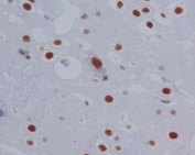 IHC staining of FFPE rat brain tissue with Phospho-STAT3 antibody. HIER: boil tissue sections in pH8 EDTA for 20 min and allow to cool before testing.