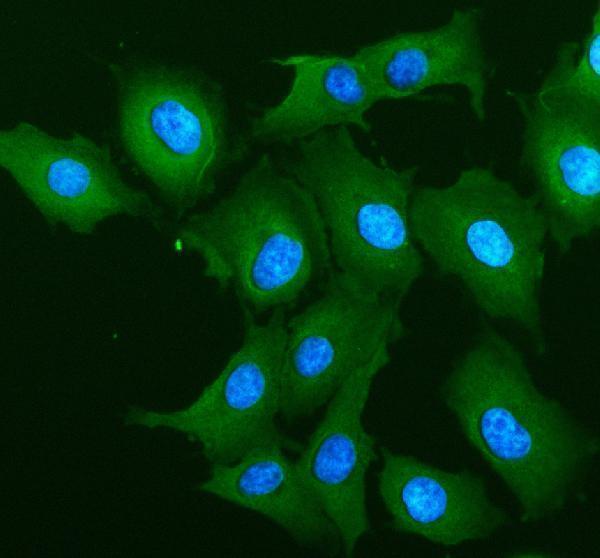 ALOX12 Antibody A549 Cell IF. Immunofluorescent staining of A549 cells with ALOX12 antibody (green). Enzymatic antigen retrieval was performed for 15 minutes prior to staining. Nuclei are counterstained with DAPI (blue). ALOX12 immunoreactivity is observed predominantly within the cytoplasm, consistent with the expected localization of 12S-Lipoxygenase (ALOX12), an arachidonic acid-metabolizing enzyme that catalyzes the formation of bioactive lipid mediators involved in platelet activation, inflammatory signaling, oxidative stress, and regulation of cellular responses.