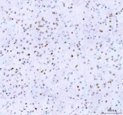 IHC staining of FFPE rat brain tissue with Islet 1 antibody. HIER: boil tissue sections in pH8 EDTA for 20 min and allow to cool before testing.
