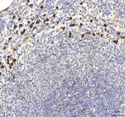 S100A12 Antibody Rabbit Polyclonal in human spleen tissue. Immunohistochemistry staining of FFPE human spleen demonstrates cytoplasmic staining in scattered inflammatory cells consistent with the known expression pattern of S100 calcium binding protein A12 / S100A12 in neutrophils and other myeloid-derived cells. Brown chromogenic signal highlights S100A12-positive inflammatory cells within splenic tissue while surrounding lymphoid cells remain largely negative. Heat-induced epitope retrieval was performed by boiling tissue sections in pH 8 EDTA buffer for 20 min before staining.