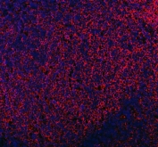 CD206 Antibody Human Tonsil IF. Immunofluorescent staining of FFPE human tonsil tissue using CD206 Antibody / Macrophage Mannose Receptor Antibody demonstrates strong red fluorescence within scattered immune cell populations distributed throughout the lymphoid tissue. The staining pattern is consistent with expression of CD206 (MRC1), a C-type lectin receptor involved in carbohydrate recognition, endocytosis, antigen processing, and macrophage-mediated immune regulation. Positive cells are observed within the tonsillar immune microenvironment, supporting the established role of CD206 as a marker of macrophages and specialized antigen-presenting cell populations. DAPI nuclear counterstain (blue) identifies cell nuclei and tissue architecture. HIER: steam section in pH8 EDTA buffer for 20 min.