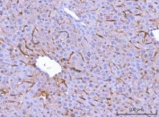 CD206 Antibody Mouse Liver IHC. Immunohistochemical staining of FFPE mouse liver tissue using CD206 Antibody / Macrophage Mannose Receptor Antibody demonstrates distinct cytoplasmic and membranous HRP-DAB brown staining within sinusoidal-associated cells and scattered hepatic immune cell populations. The staining pattern is consistent with expression of CD206 (MRC1), a C-type lectin receptor that mediates carbohydrate recognition, receptor-mediated endocytosis, antigen uptake, and macrophage-associated immune functions. Positive immunoreactivity is observed throughout the liver parenchyma and is compatible with resident macrophage populations involved in immune surveillance, clearance of extracellular material, and maintenance of hepatic homeostasis. HIER: boil tissue sections in pH8 EDTA for 20 min and allow to cool before testing.