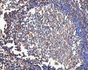 CD206 Antibody Human Tonsil IHC. Immunohistochemical staining of FFPE human tonsil tissue using CD206 Antibody / Macrophage Mannose Receptor Antibody demonstrates distinct cytoplasmic and membranous HRP-DAB brown staining within scattered immune cell populations distributed throughout the lymphoid tissue. The staining pattern is consistent with expression of CD206 (MRC1), a C-type lectin receptor involved in carbohydrate recognition, receptor-mediated endocytosis, antigen processing, and macrophage-mediated immune regulation. Positive immunoreactivity is observed in cells compatible with macrophage and antigen-presenting cell populations within the tonsillar microenvironment, supporting the established role of CD206 as a marker of innate immune cell function and tissue immune surveillance. HIER: boil tissue sections in pH8 EDTA for 20 min and allow to cool before testing.
