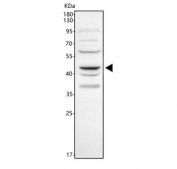 Western blot testing of human SiHa cell lysate with WNT5A antibody. Predicted molecular weight ~41 kDa, commonly observed at 41-45 kDa.