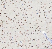 TARDBP Antibody Mouse Brain Tissue Immunohistochemistry. IHC staining of FFPE mouse brain tissue with TARDBP antibody. HIER: boil tissue sections in pH8 EDTA for 20 min and allow to cool before testing.