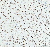 TARDBP Antibody Rat Brain Tissue Immunohistochemistry. IHC staining of FFPE rat brain tissue with TARDBP antibody. HIER: boil tissue sections in pH8 EDTA for 20 min and allow to cool before testing.