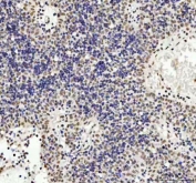TARDBP Antibody Spleen Immunohistochemistry. IHC staining of FFPE human spleen tissue with TARDBP antibody. HIER: boil tissue sections in pH8 EDTA for 20 min and allow to cool before testing.