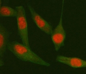 TARDBP Antibody HeLa Cell IF. Immunofluorescent staining of FFPE human HeLa cells with TARDBP antibody (red) and Beta Tubulin mAb (green). HIER: steam section in pH6 citrate buffer for 20 min.