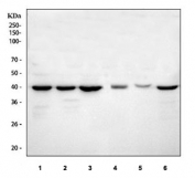 TARDBP Antibody WB. Western blot testing of 1) human HeLa, 2) human Jurkat, 3) human HepG2, 4) rat C6, 5) mouse pancreas and 6) mouse Neuro-2a cell lysate with TARDBP antibody. Predicted molecular weight ~45 KDa, commonly observed at 43-45 kDa.