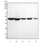 Western blot testing of 1) human Jurkat, 2) human HEL, 3) rat C6, 4) mouse testis and 5) mouse RAW264.7 cell lysate with LRRC34 antibody. Predicted molecular weight ~51 kDa and ~48 kDa (two isoforms).