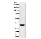 Western blot testing of human Jurkat cell lysate with TSFM antibody. Predicted molecular weight ~35 kDa.