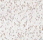 IHC staining of FFPE human rat brain tissue with PHF6 antibody. HIER: boil tissue sections in pH8 EDTA for 20 min and allow to cool before testing.