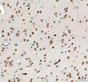 IHC staining of FFPE human mouse brain tissue with PHF6 antibody. HIER: boil tissue sections in pH8 EDTA for 20 min and allow to cool before testing.