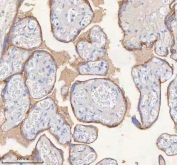 HER4 Antibody FFPE Placenta IHC. Immunohistochemistry staining of FFPE human placental tissue with HER4 antibody. HIER: boil tissue sections in pH8 EDTA for 20 min and allow to cool before testing.