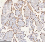 HER4 Antibody Human Placental Tissue IHC. Immunohistochemistry of HER4 antibody in human placental tissue. FFPE human placenta sections were subjected to heat-induced epitope retrieval by boiling in pH 8 EDTA for 20 minutes followed by cooling prior to staining. The rabbit polyclonal HER4 antibody was used as the detecting antibody. HRP-DAB brown staining is observed predominantly along the membranous borders of trophoblastic cells with additional cytoplasmic signal, while surrounding stromal components display lower background staining. The staining pattern is consistent with Erb-B2 receptor tyrosine kinase 4 expression in placental tissue.
