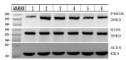Phospho-mTOR (pSer2448) Antibody 4T1 WB. Western blot analysis of mouse 4T1 cell lysates including untreated, LPS-stimulated, and drug-treated conditions using phospho-mTOR antibody detecting mTOR phosphorylated at Ser2448, clone IFF-13. Lane 1: untreated, Lane 2: LPS-stimulated, Lane 3-5: increasing drug doses, Lane 6: positive control drug. A band is detected at approximately 289 kDa, consistent with the predicted molecular weight of mTOR. Phospho-mTOR levels vary across treatment conditions, reflecting modulation of mTOR pathway activity. Total mTOR and Actin are shown as controls.