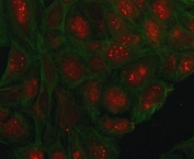 Immunofluorescent staining of FFPE human U-2 OS cells with PHC1 antibody (red) and DAPI nuclear stain (blue). HIER: steam section in pH6 citrate buffer for 20 min.
