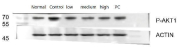Phospho-AKT1 (pT450) Antibody Rat Colon WB. Western blot analysis of rat colon tissue lysates under normal, control, low-dose, medium-dose, and positive treatment conditions shows a band at approximately 70 kDa using phospho-AKT1 (pT450) antibody, compared to the predicted molecular weight of ~56 kDa for AKT1, consistent with phosphorylation-dependent mobility shift and activation state of the kinase; signal intensity varies across treatment groups, reflecting modulation of AKT1 phosphorylation, while ACTIN serves as a loading control; clone HEA-1 was used for detection.