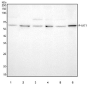 Phospho-AKT1 (pT450) Antibody WB. Western blot testing of 1) human HeLa, 2) human MCF7, 3) rat brain, 4) rat PC-12, 5) mouse brain and 6) mouse NIH 3T3 cell lysate with Phospho-AKT1 Antibody.
