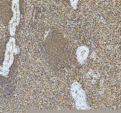 IHC staining of FFPE human spleen tissue with SMIM8 antibody. HIER: boil tissue sections in pH8 EDTA for 20 min and allow to cool before testing.