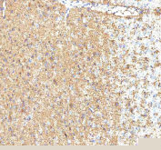 IHC staining of FFPE mouse brain tissue with Hcn2 antibody. HIER: boil tissue sections in pH8 EDTA for 20 min and allow to cool before testing.