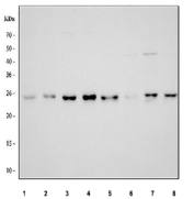 Western blot analysis using RPE antibody. Lane 1: human 293T whole cell lysates; Lane 2: human HeLa whole cell lysates; Lane 3: human K-562 whole cell lysates; Lane 4: human HepG2 whole cell lysates; Lane 5: rat thymus tissue lysates; Lane 6: rat RH35 whole cell lysates; Lane 7: mouse thymus tissue lysates; Lane 8: mouse NIH/3T3 whole cell lysates. The predicted molecular weight of Ribulose-phosphate 3-epimerase is ~25 kDa. A predominant band is observed near the expected size across samples, with minor variation in apparent molecular weight consistent with context-dependent electrophoretic behavior.