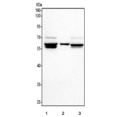 Western blot testing of human 1) PC-3, 2) U-2 OS and 3) MCF7 cell lysate with PGM5 antibody. Predicted molecular weight ~62 kDa.