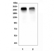 Western blot testing of 1) rat skeletal muscle and 2) mouse skeletal muscle tissue lysate with ACACB antibody. Predicted molecular weight ~277 kDa.