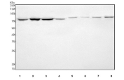 Western blot testing of 1) human K562, 2) human HeLa, 3) human SiHa, 4) human A549, 5) rat skeletal muscle, 6) rat ovary, 7) mouse skeletal muscle and 8) mouse ovary tissue lysate with AqCbl reductase antibody. Predicted molecular weight: 78-80 kDa (two isoforms).
