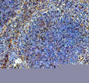 IHC staining of FFPE mouse spleen tissue with Cd244 antibody, HRP-secondary and DAB substrate. HIER: boil tissue sections in pH8 EDTA for 20 min and allow to cool before testing.