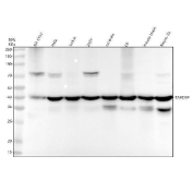 TARDBP Antibody Multi-Species WB. Western blot analysis of human SH-SY5Y, HeLa, Jurkat, and 293T cell lysates together with rat brain, rat C6, mouse brain, and mouse Neuro-2a samples using anti-TARDBP antibody. A prominent band is detected near 40-45 kDa across multiple human, rat, and mouse samples, consistent with the expected molecular weight range of TAR DNA-binding protein 43 / TDP-43. Additional lower molecular weight bands observed in select neural-derived samples may reflect proteolytic processing or disease-associated TDP-43 fragment species reported in neuronal tissues and neurodegeneration-related pathways.