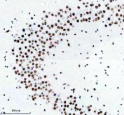 TARDBP Antibody Mouse Brain IHC. Immunohistochemistry analysis of FFPE mouse brain tissue stained with anti-TARDBP antibody. Following heat-induced epitope retrieval in pH 8 EDTA buffer, strong HRP-DAB brown nuclear staining is observed in neuronal cell populations, consistent with the known nuclear localization of TAR DNA-binding protein 43 / TDP-43, an RNA-binding protein involved in RNA splicing, stress granule biology, and neurodegeneration-associated RNA processing pathways.