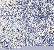 TARDBP Antibody Tonsil IHC. Immunohistochemistry analysis of FFPE human tonsil tissue stained with anti-TARDBP antibody. Following heat-induced epitope retrieval in pH 8 EDTA buffer, nuclear HRP-DAB brown staining is observed in scattered lymphoid and stromal cell populations, consistent with expression of TAR DNA-binding protein 43 / TDP-43, an RNA-binding protein involved in RNA splicing, stress granule dynamics, and post-transcriptional gene regulation.