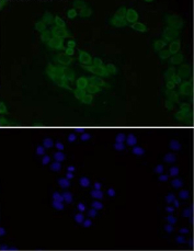 Immunofluorescent staining of FFPE human HeLa cells with Alpha-Synuclein antibody (green) and DAPI nuclear stain (blue). HIER: steam section in pH6 citrate buffer for 20 min.